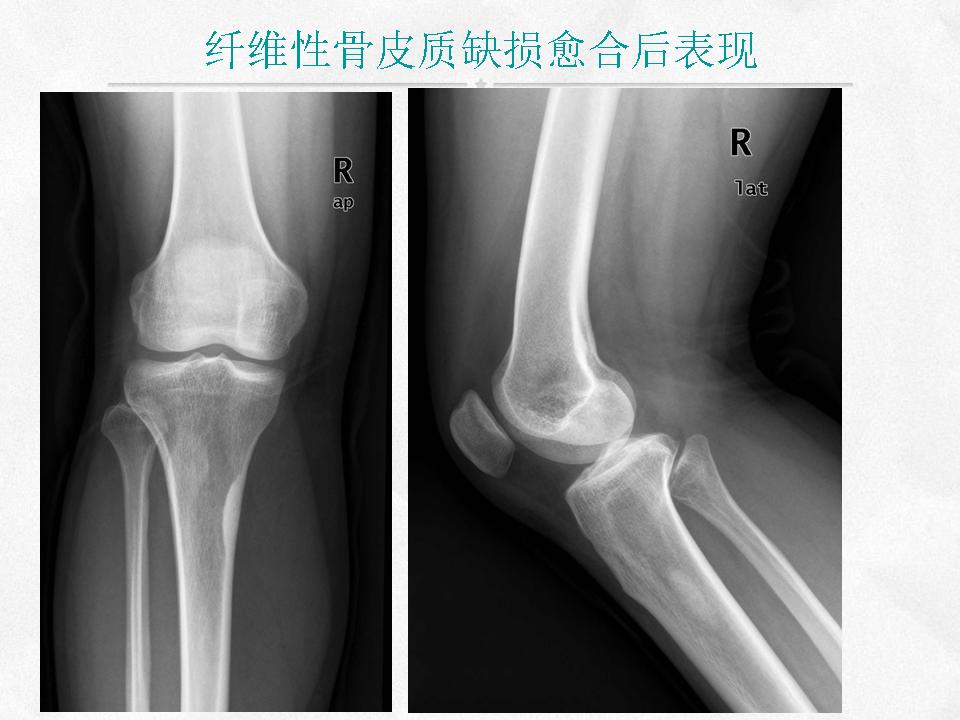 %e5%b9%bb%e7%81%af%e7%89%878