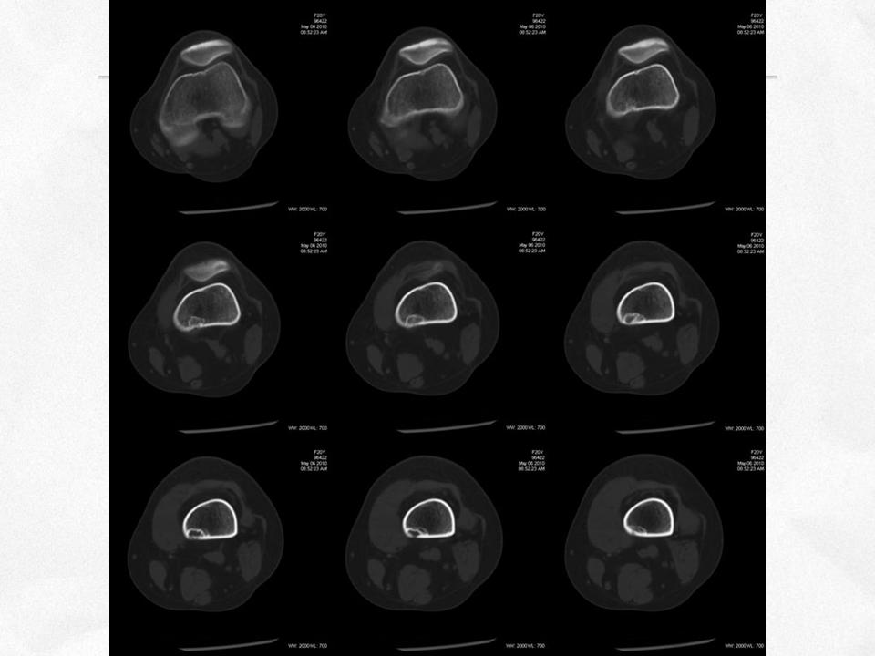 %e5%b9%bb%e7%81%af%e7%89%8713