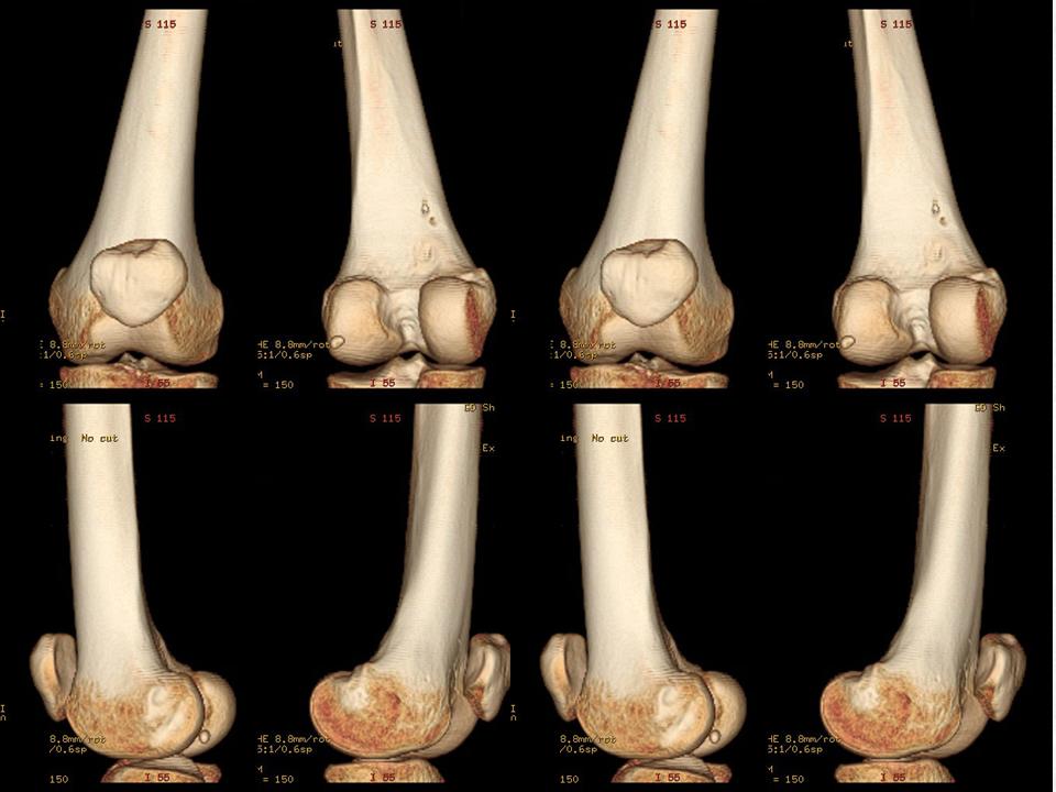 %e5%b9%bb%e7%81%af%e7%89%8715