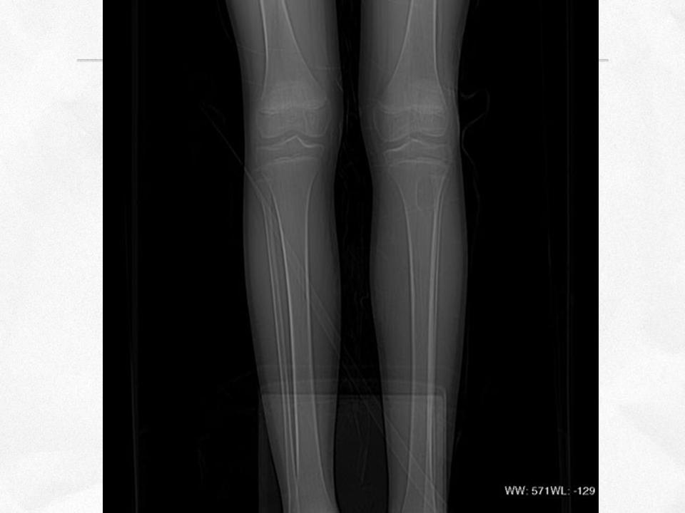 %e5%b9%bb%e7%81%af%e7%89%8717