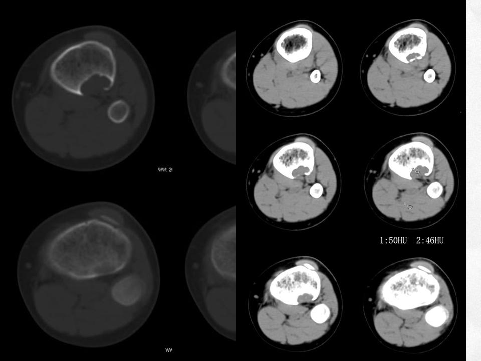 %e5%b9%bb%e7%81%af%e7%89%8718