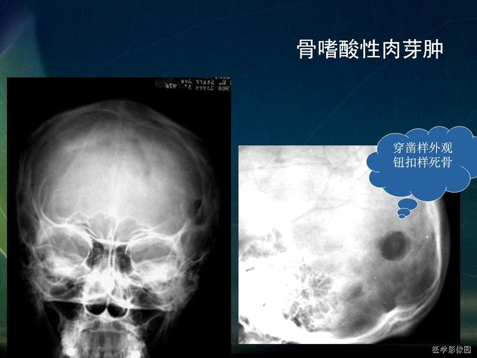 %e5%b9%bb%e7%81%af%e7%89%8723