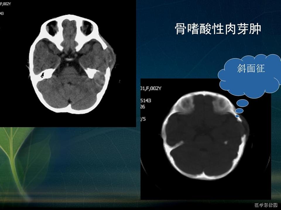 %e5%b9%bb%e7%81%af%e7%89%8724