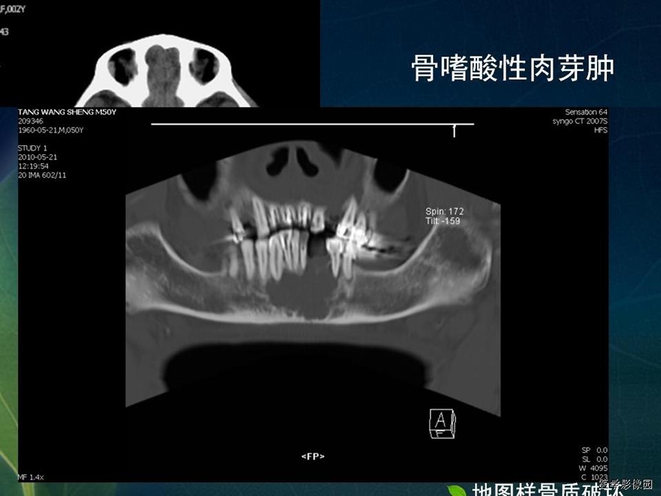 %e5%b9%bb%e7%81%af%e7%89%8725