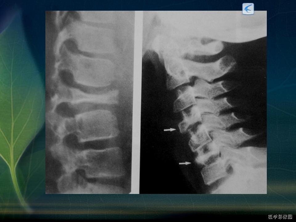 %e5%b9%bb%e7%81%af%e7%89%8729