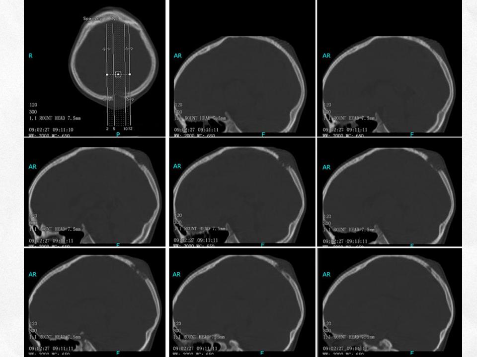 %e5%b9%bb%e7%81%af%e7%89%8733