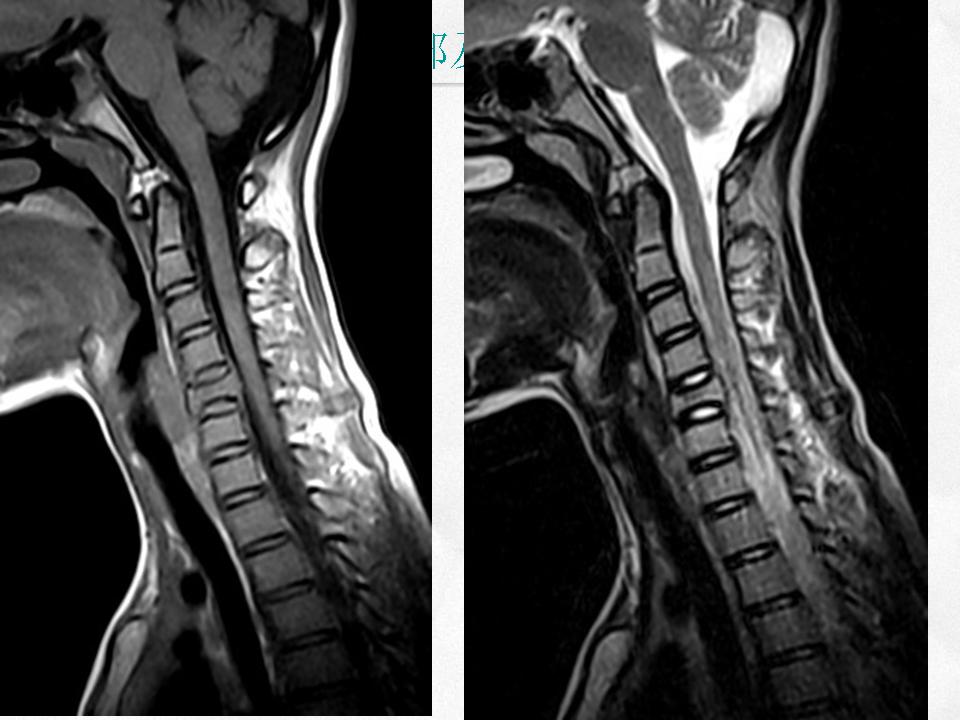 %e5%b9%bb%e7%81%af%e7%89%8735