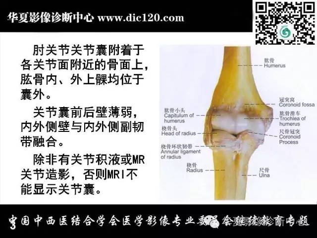 【PPT】肘关节疾病磁共振诊断