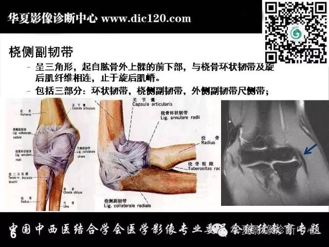 【PPT】肘关节疾病磁共振诊断