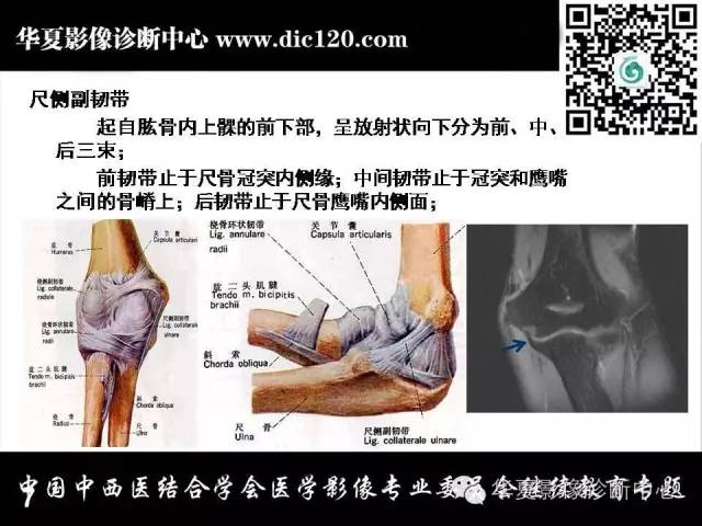 【PPT】肘关节疾病磁共振诊断