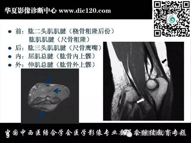 【PPT】肘关节疾病磁共振诊断