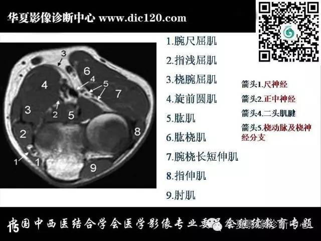【PPT】肘关节疾病磁共振诊断