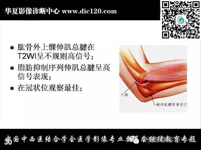 【PPT】肘关节疾病磁共振诊断