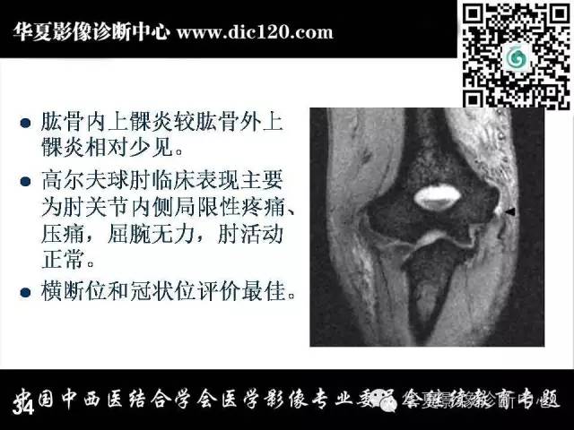 【PPT】肘关节疾病磁共振诊断
