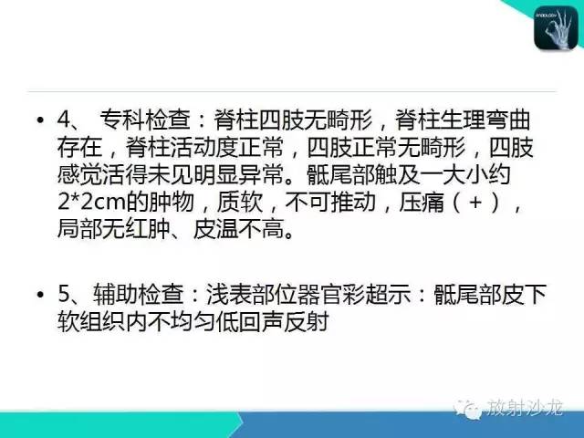 【病例】骶尾部表皮样囊肿1例CT