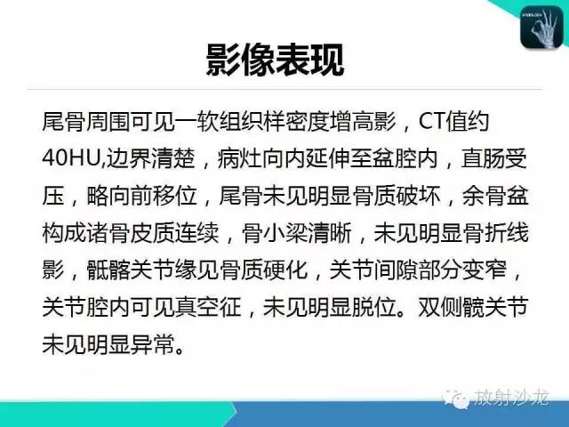 【病例】骶尾部表皮样囊肿1例CT