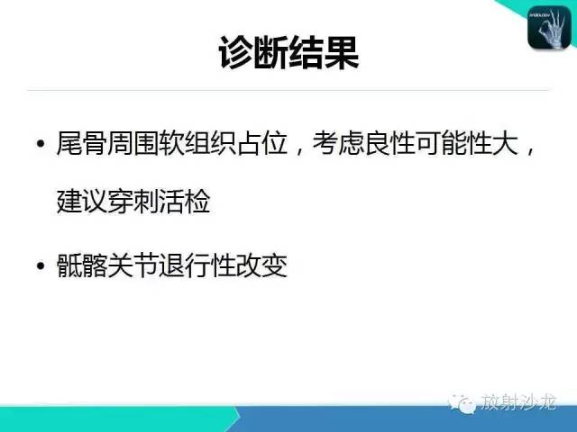 【病例】骶尾部表皮样囊肿1例CT