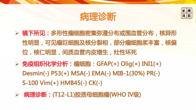 【病例】脊髓胶质母细胞瘤1例MR影像表现与鉴别