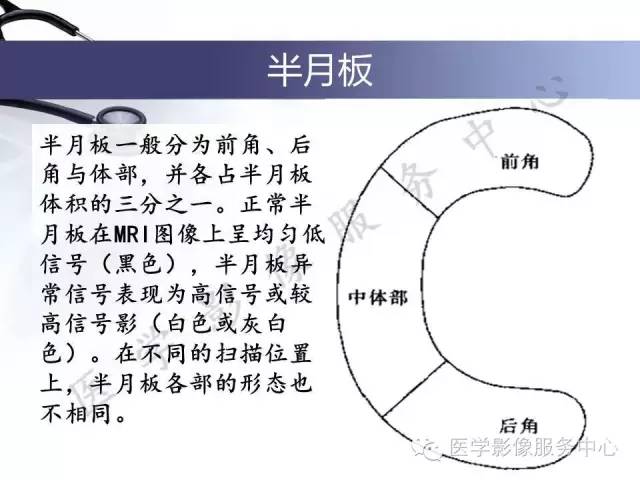 【PPT】半月板病变的MRI诊断
