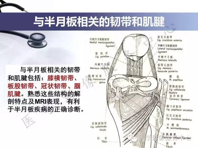 【PPT】半月板病变的MRI诊断