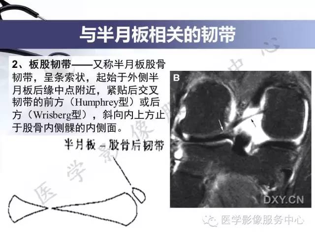 【PPT】半月板病变的MRI诊断