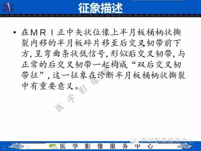 【影像征象】双后交叉韧带征