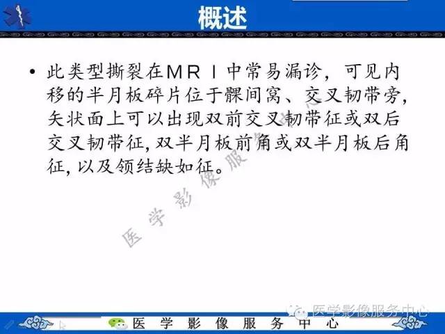 【影像征象】双后交叉韧带征