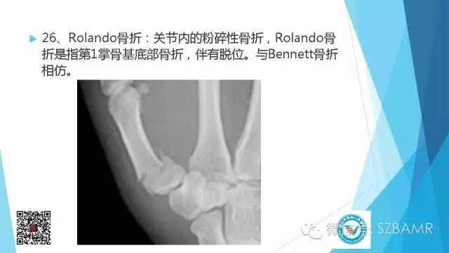 【PPT】(40种)特殊骨折命名方法及图示