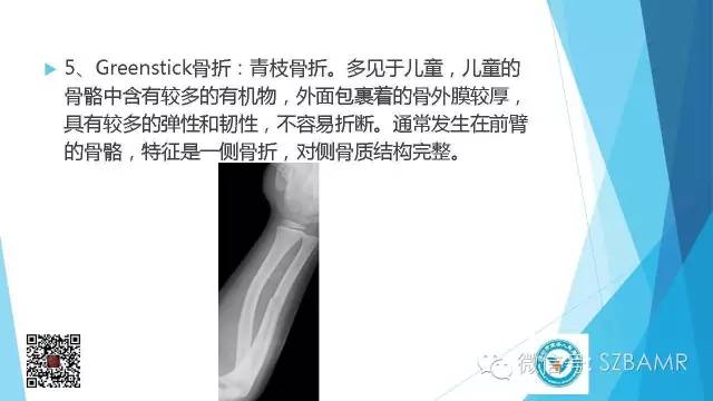【PPT】(40种)特殊骨折命名方法及图示