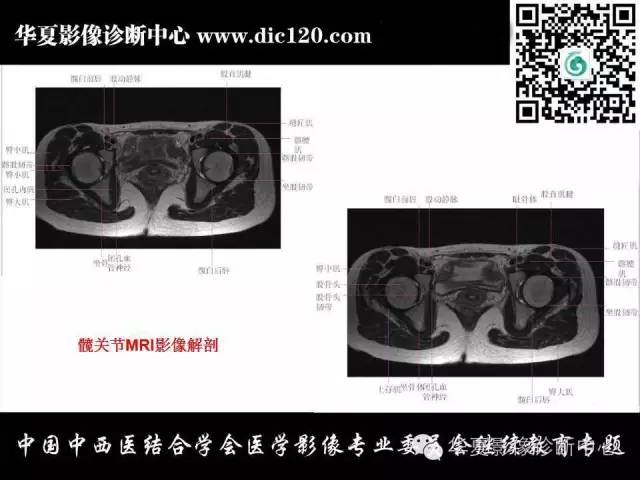 【PPT】髋关节常见疾病影像学诊断