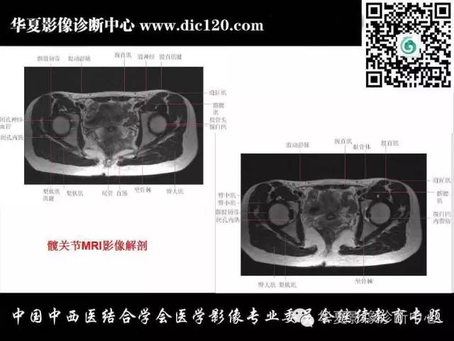 【PPT】髋关节常见疾病影像学诊断