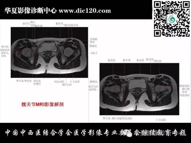 【PPT】髋关节常见疾病影像学诊断