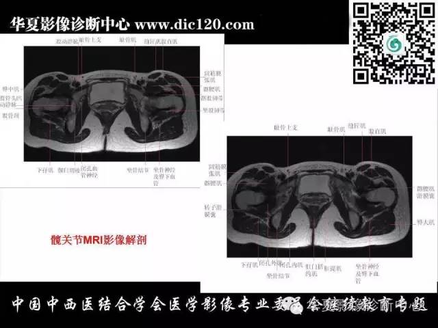 【PPT】髋关节常见疾病影像学诊断