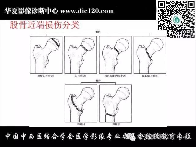 【PPT】髋关节常见疾病影像学诊断