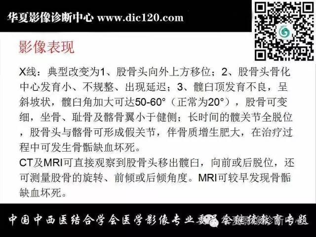 【PPT】髋关节常见疾病影像学诊断