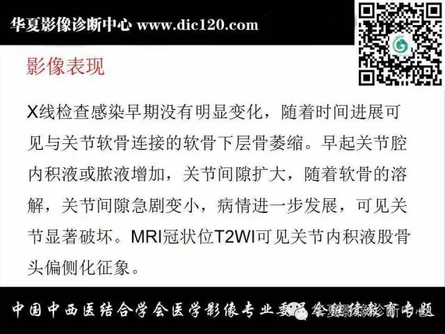 【PPT】髋关节常见疾病影像学诊断