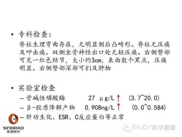 【病例】右侧髂骨血管内皮瘤1例CT及MR病例读片