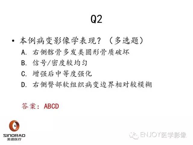 【病例】右侧髂骨血管内皮瘤1例CT及MR病例读片