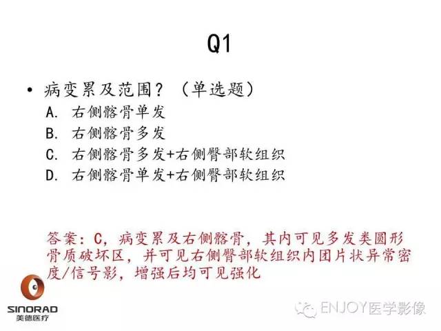 【病例】右侧髂骨血管内皮瘤1例CT及MR病例读片