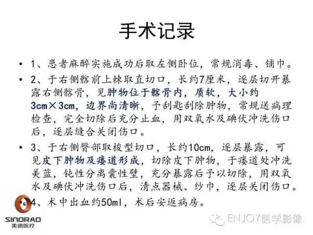 【病例】右侧髂骨血管内皮瘤1例CT及MR病例读片