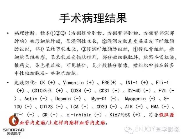 【病例】右侧髂骨血管内皮瘤1例CT及MR病例读片