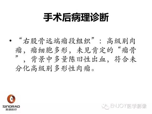 【病例】右侧股骨多形性肉瘤1例X线及MR影像表现