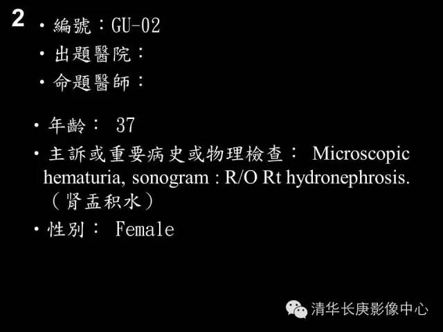 【病例】肾下垂1例影像表现
