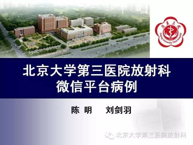 【病例】肠道白塞氏病1例X线CT