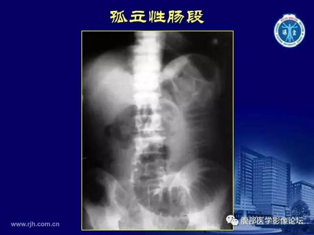 【PPT】急腹症