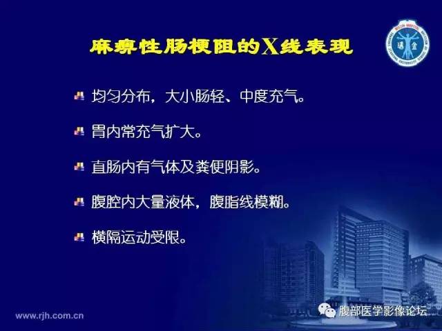 【PPT】急腹症