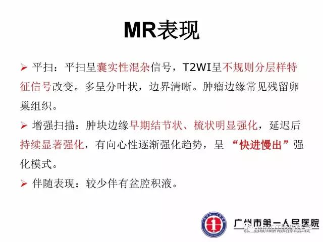 【病例】卵巢硬化性间质瘤1例MR