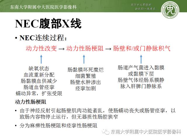 【病例】新生儿坏死性肠炎1例X线CT影像表现 【病例】新生儿坏死性肠炎1例X线CT影像表现