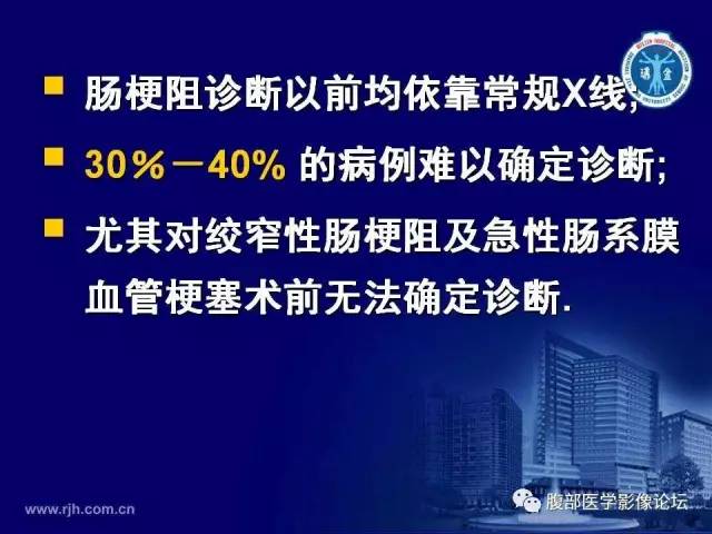 【PPT】急性绞窄性肠梗阻CT诊断
