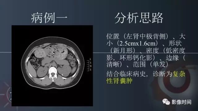 【PPT】肾脏高密度螺旋 CT 诊断思路